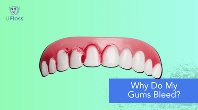 Why Do My Gums Bleed?